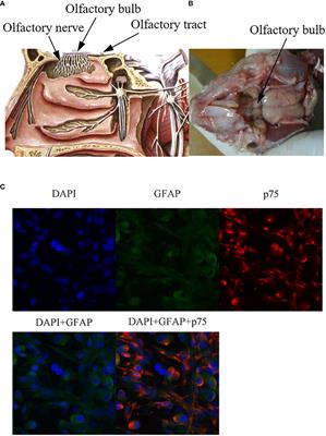 Potential therapeutic effect of olfactory ensheathing cells in neurological diseases: neurodegenerative diseases and peripheral nerve injuries
